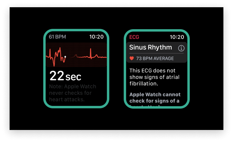 Apple Watch electrocardiogram app